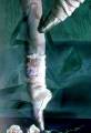Ballett